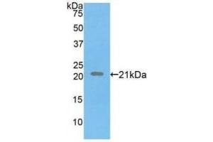 Detection of Recombinant FBN1, Human using Polyclonal Antibody to Fibrillin 1 (FBN1) (Fibrillin 1 抗体  (AA 723-902))