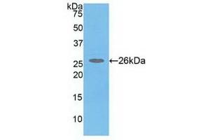 Detection of Recombinant COMT, Human using Polyclonal Antibody to Catechol-O-Methyltransferase (COMT) (COMT 抗体  (AA 52-271))