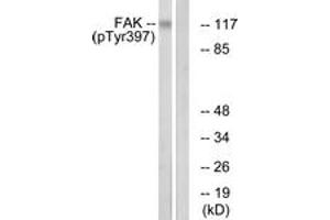 Western blot analysis of extracts from Jurkat cells treated with Ca2+ 40nM 30', using FAK (Phospho-Tyr397) Antibody. (FAK 抗体  (pTyr397))