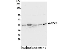 anti-Syntaxin 12 (STX12) (AA 1-50) antibody