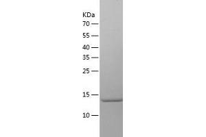 Western Blotting (WB) image for Small Nuclear Ribonucleoprotein D2 Polypeptide 16.5kDa (SNRPD2) (AA 1-118) protein (His tag) (ABIN7286701) (SNRPD2 Protein (AA 1-118) (His tag))