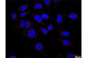 Proximity Ligation Analysis of protein-protein interactions between HSPB1 and F13A1. (F13A1 抗体  (AA 1-732))