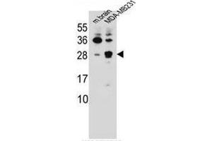 CBLN2 Antibody (C-term) western blot analysis in mouse brain tissue and MDA-MB231 cell line lysates (35ug/lane). (CBLN2 抗体  (C-Term))