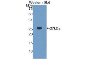 Western Blotting (WB) image for anti-Toll-Like Receptor 6 (TLR6) (AA 608-796) antibody (ABIN1860775) (TLR6 抗体  (AA 608-796))
