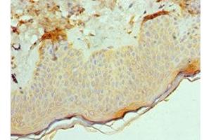 Immunohistochemistry of paraffin-embedded human skin tissue using ABIN7143181 at dilution of 1:100 (ACVR2A 抗体  (AA 20-140))
