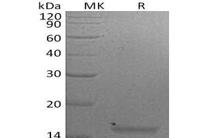 Western Blotting (WB) image for Interleukin 21 (IL21) protein (ABIN7320585) (IL-21 蛋白)