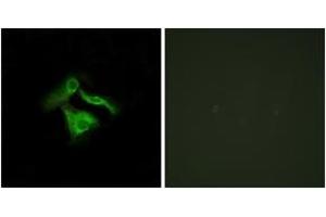 Immunofluorescence analysis of HeLa cells, using GPR149 Antibody. (GPR149 抗体  (AA 451-500))