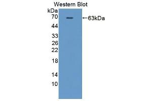Western blot analysis of the recombinant protein. (HCK 抗体  (AA 2-524))