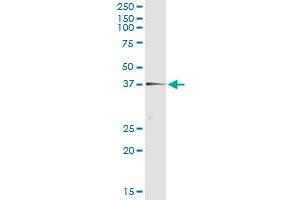 Immunoprecipitation of TEX264 transfected lysate using anti-TEX264 monoclonal antibody and Protein A Magnetic Bead , and immunoblotted with TEX264 MaxPab rabbit polyclonal antibody. (TEX264 抗体  (AA 1-313))