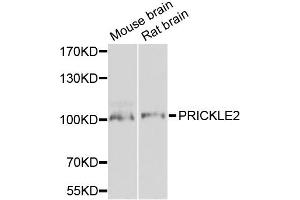 Western blot analysis of extracts of various cell lines, using PRICKLE2 antibody. (PRICKLE2 抗体)