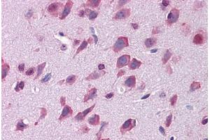 Mouse brain: Formalin-Fixed, Paraffin-Embedded (FFPE) (LAMP1 抗体  (FITC))