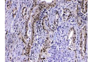 IHC analysis of MED15 using anti-MED15 antibody . (MED15 抗体  (AA 1-285))