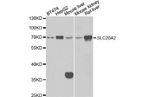 Western blot analysis of extracts of various cell lines, using SLC20A2 antibody (ABIN5974076) at 1/1000 dilution. (SLC20A2 抗体)