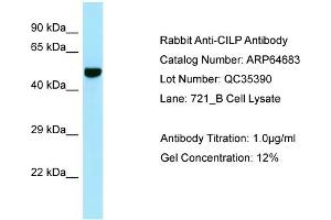 Western Blotting (WB) image for anti-Cartilage Intermediate Layer Protein, Nucleotide Pyrophosphohydrolase (CILP) (C-Term) antibody (ABIN970398) (CILP 抗体  (C-Term))