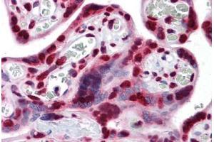Human Placenta: Formalin-Fixed, Paraffin-Embedded (FFPE) (PTBP1 抗体  (AA 45-145))