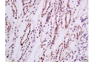 Formalin-fixed and paraffin embedded Human kidney tissue labeled with Anti-PKC epsilon Polyclonal Antibody, Unconjugated 1:200 followed by conjugation to the secondary antibody and DAB staining (PKC epsilon 抗体  (AA 631-737))
