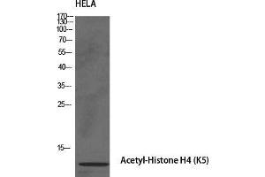 Western Blot (WB) analysis of specific cells using Acetyl-Histone H4 (K5) Polyclonal Antibody. (Histone H4 抗体  (acLys5))