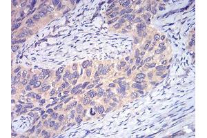Immunohistochemistry (IHC) image for anti-DEAD (Asp-Glu-Ala-Asp) Box Polypeptide 3, X-Linked (DDX3X) (AA 518-661) antibody (ABIN5542508)
