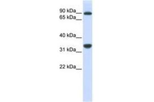 Image no. 1 for anti-Ribosomal RNA Processing 1 Homolog B (RRP1B) (AA 684-733) antibody (ABIN6740938) (RRP1B 抗体  (AA 684-733))