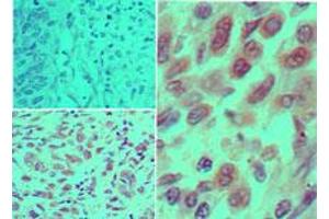 IKK alpha Immunohistochemistry. (IKK alpha 抗体)