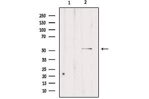 Western blot analysis of extracts from rat brain, using CPE Antibody. (CPE 抗体  (Internal Region))