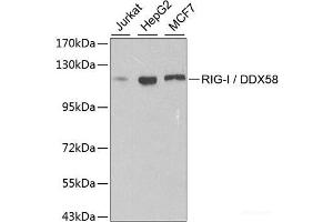 Western blot analysis of extracts of various cell lines using RIG-I / DDX58 Polyclonal Antibody at dilution of 1:500. (DDX58 抗体)