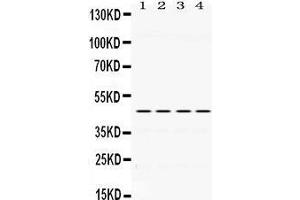 Western Blotting (WB) image for anti-Paired Box 6 (PAX6) (AA 195-233), (Middle Region) antibody (ABIN3043379) (PAX6 抗体  (Middle Region))