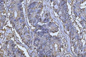 IHC analysis of CD147/Emmprin using anti-CD147/Emmprin antibody (ABIN7599999).