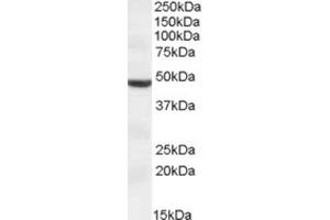 Western Blotting (WB) image for anti-Transmembrane Protease, serine 4 (TMPRSS4) (Internal Region) antibody (ABIN2464170) (TMPRSS4 抗体  (Internal Region))