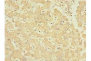 Immunohistochemistry of paraffin-embedded human liver tissue using ABIN7151868 at dilution of 1:100 (EPH Receptor B4 抗体  (AA 300-540))