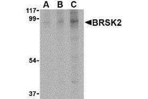 Western blot analysis of BRSK2 in human brain tissue lysate with AP30168PU-N BRSK2 antibody at (A) 0.