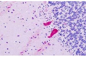 anti-Nuclear Receptor Subfamily 1, Group I, Member 3 (NR1I3) (AA 71-120) antibody