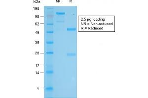 SDS-PAGE Analysis Purified Tyrosinase Rabbit Recombinant Monoclonal Antibody (TYR/2024R). (Recombinant TYR 抗体)