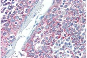 Human Tonsil (formalin-fixed, paraffin-embedded) stained with DIABLO antibody ABIN462354 followed by biotinylated anti-mouse IgG secondary antibody ABIN481714, alkaline phosphatase-streptavidin and chromogen. (DIABLO 抗体)