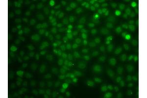 Immunofluorescence analysis of A549 cells using CBLC antibody (ABIN5975726). (CBLC 抗体)