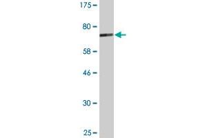 Western Blot detection against Immunogen (77. (CBLC 抗体  (AA 1-474))
