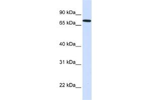 WB Suggested Anti-SETDB2 Antibody Titration:  0. (SETDB2 抗体  (N-Term))