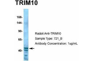 Western Blotting (WB) image for anti-Tripartite Motif Containing 10 (TRIM10) (C-Term) antibody (ABIN2775785)
