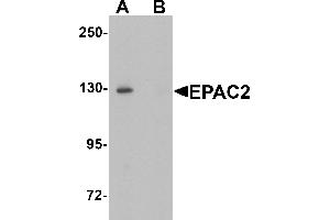Western blot analysis of EPAC2 in rat liver tissue lysate with EPAC2 antibody at 1 µg/mL in (A) the absence and (B) the presence of blocking peptide. (RAPGEF4 抗体  (N-Term))