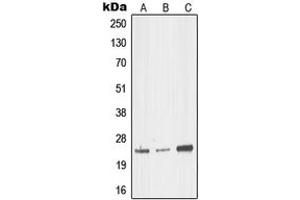 Western blot analysis of MED18 expression in HEK293T (A), mouse brain (B), rat kidney (C) whole cell lysates. (MED18 抗体  (Center))