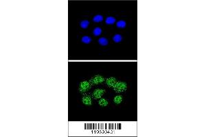 Confocal immunofluorescent analysis of MSH2 Antibody with Hela cell followed by Alexa Fluor 488-conjugated goat anti-rabbit lgG (green). (MSH2 抗体  (AA 637-665))