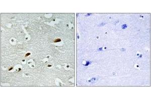 Immunohistochemistry analysis of paraffin-embedded human brain tissue, using TIP60 Antibody. (KAT5 抗体  (AA 371-420))