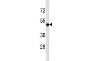 Western Blotting (WB) image for anti-Tumor Necrosis Factor Receptor Superfamily, Member 25 (TNFRSF25) (AA 214-242) antibody (ABIN3029372)