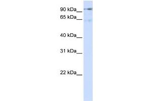 WB Suggested Anti-DLG7 Antibody Titration:  0. (DLGAP5 抗体  (N-Term))
