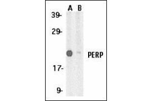 Western blot analysis of PERP expression in A431 whole cell lysates in the absence (A) and presence (B) of blocking peptide with this product at 1 μg /ml. (PERP 抗体  (C-Term))