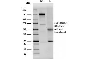 SDS-PAGE (SDS) image for anti-Dystrophin (DMD) (AA 114-263) antibody (ABIN6939242)