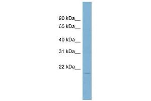 Coactosin-Like 1 antibody used at 1 ug/ml to detect target protein. (COTL1 抗体)