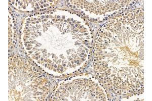ABIN6256903 and ABIN6275795 at 1/100 staining rat testis tissue by IHC-P. (ANAPC5 抗体  (Internal Region))