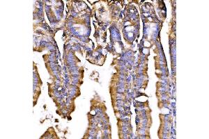 IHC analysis of GPR54/KISS1R using anti-GPR54/KISS1R antibody (ABIN7602153).