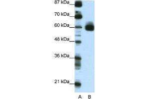 WB Suggested Anti-CIR Antibody Titration:  0. (KCNJ5 抗体  (C-Term))